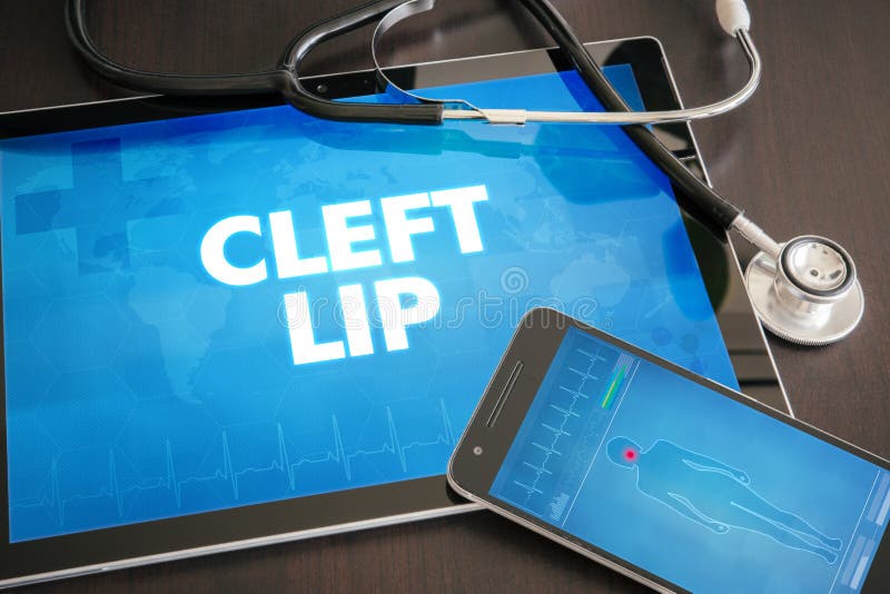 Cleft lip (congenital disorder) diagnosis medical concept on tablet screen with stethoscope. Cleft lip (congenital disorder) diagnosis medical concept on tablet screen with stethoscope.