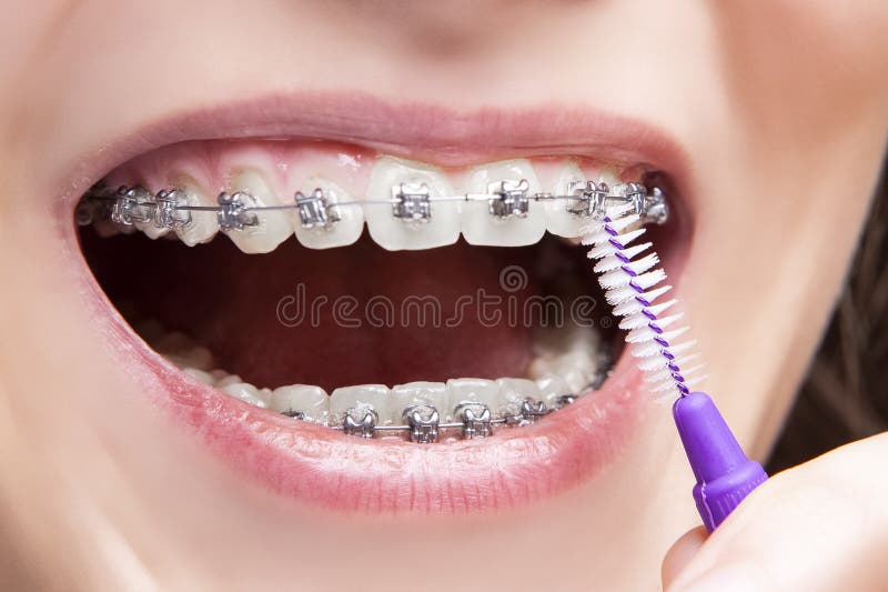 Concepts d'hygiène dentaire Fermeture extrême de la bouche adolescente à l'aide d'un pinceau pour nettoyer les dents et les dents