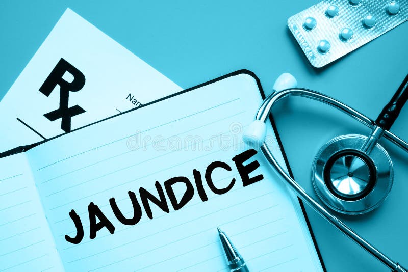 Conceptual hand written text showing Jaundice stock photo