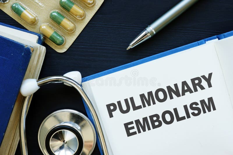 Conceptual hand written text showing Pulmonary embolism stock image