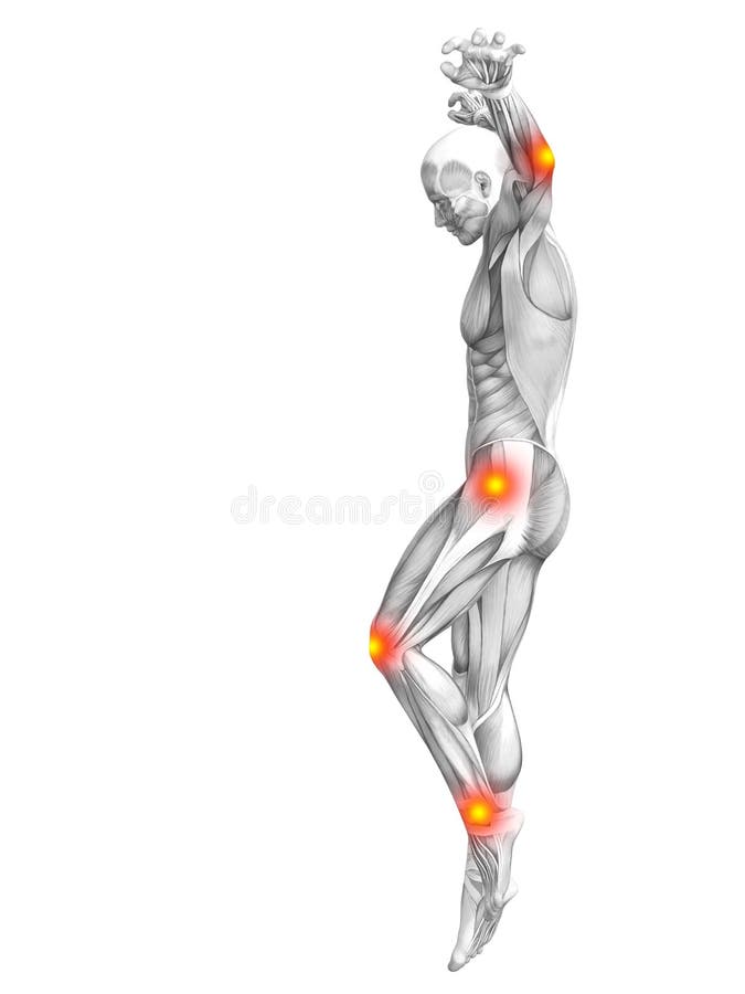 Human Muscle Anatomy Hot Spot Inflammation Stock Illustration