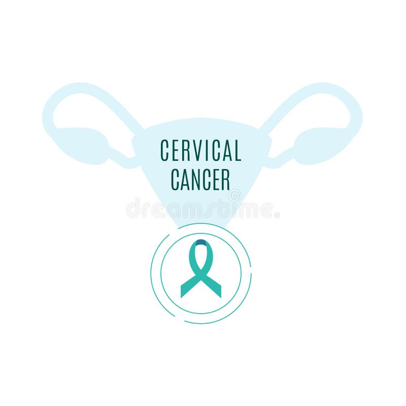 CONCIENCIA DEL CÁNCER DE CUELLO DEL ÚTERO ilustración del vector CONCIENCIA DEL CÁNCER DE CUELLO DEL ÚTERO ilustración del vector