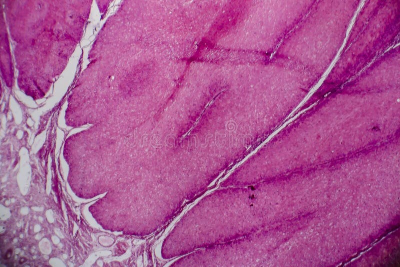 condyloma acuminata gp notebook