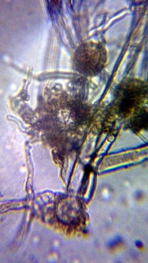 Aspergillus niger the black mold conidia under the microscope stock photography
