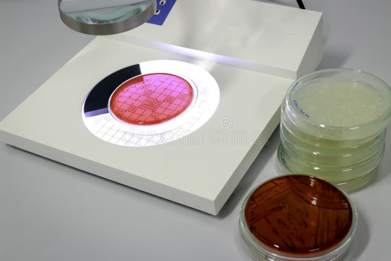 Contador de colonias y fluido en vidrios de placa petri con cultivos crecientes de microorganismos hongos y microbios torre de pla