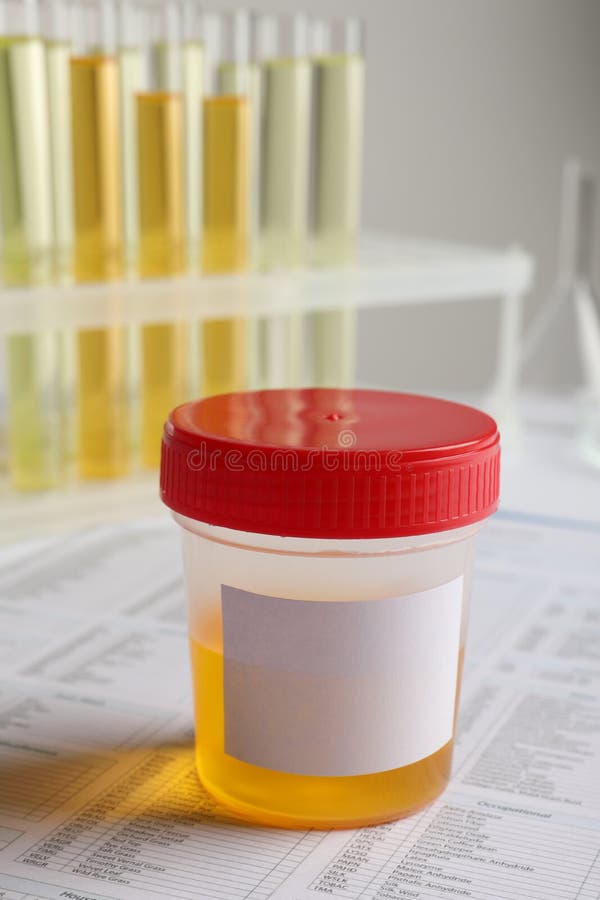 Container with Urine Sample for Analysis on Table Stock Photo Image