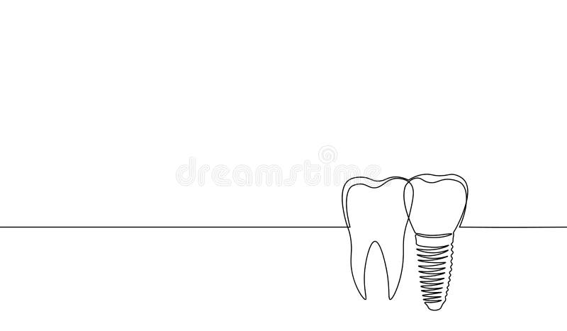 Continu simple implant humain anatomique de silhouette de dent de schéma Cavité molaire de racine de récupération saine de médeci illustration libre de droits Continu simple implant humain anatomique de silhouette de dent de schéma Cavité molaire de racine de récupération saine de médeci illustration libre de droits