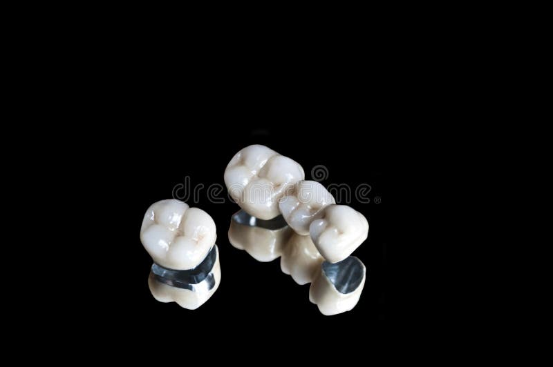 Corone dentarie ceramiche fotografia stock libera da diritti Corone dentarie ceramiche fotografia stock libera da diritti