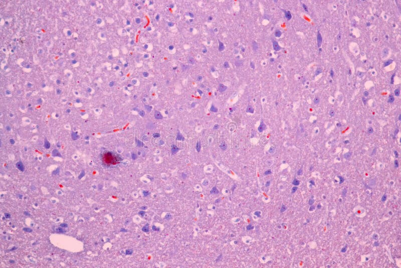 Cross section of the Cerebellum and Nerve human under the microscope for education in Lab. Cross section of the Cerebellum and Nerve human under the microscope for education in Lab.