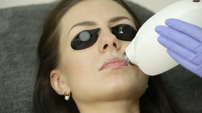 Cosmetologist doet de verwijdering van het laserhaar op gezicht van patiënt Epilationprocedure stock videobeelden Cosmetologist doet de verwijdering van het laserhaar op gezicht van patiënt Epilationprocedure stock videobeelden