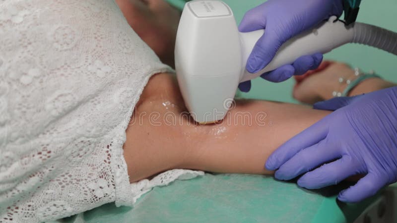 Cosmetologist makes laser hair removal on armpits. Cosmetologist makes video
