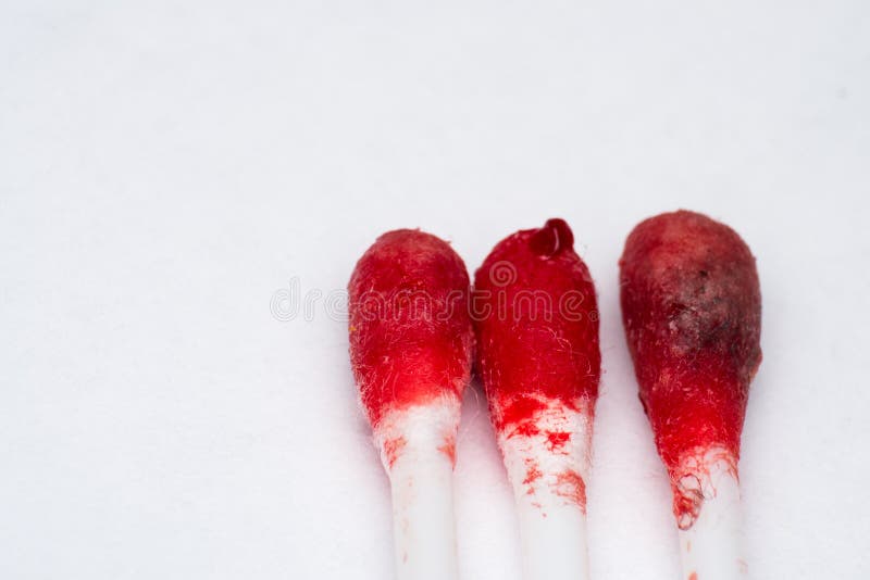 Ear Bleeding Photos Free Royalty Free Stock Photos From Dreamstime