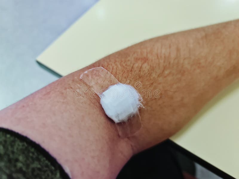 Cotton Pad on Man`s Arm after Blood Test Stock Photo Image of doctor