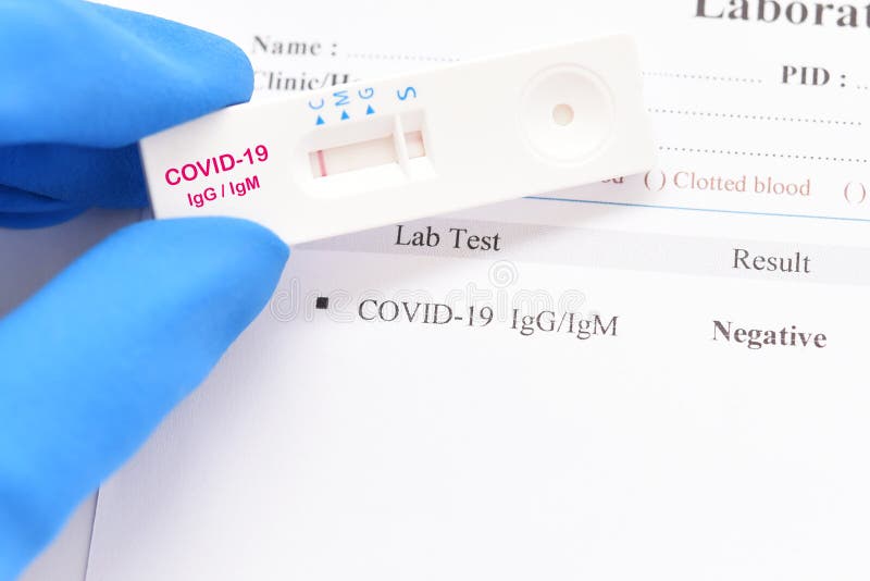 COVID19 Negative Test Result By Using Rapid Card Test Stock Image