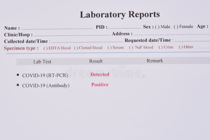 COVID-19 test results by using RT-PCR method and rapid test antibody method stock images