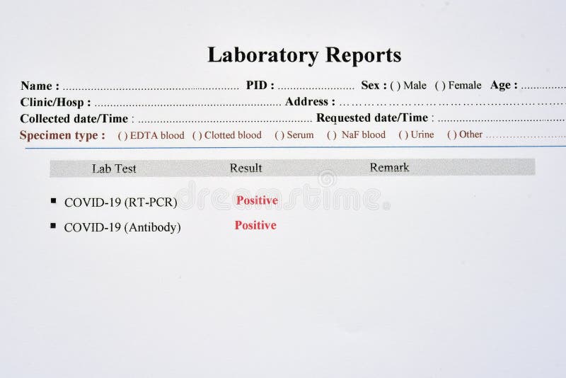 COVID-19 positive test results royalty free stock images