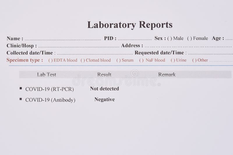 COVID-19 test results by using RT-PCR method and rapid test antibody method royalty free stock photo