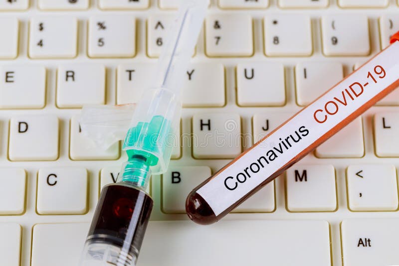 COVID- 19 άτυπη πνευμονία, ορισμός ιού Μέση Ανατολή Αναπνευστικό σύνδρομο Εξέταση αίματος στοκ φωτογραφία COVID- 19 άτυπη πνευμονία, ορισμός ιού Μέση Ανατολή Αναπνευστικό σύνδρομο Εξέταση αίματος στοκ φωτογραφία