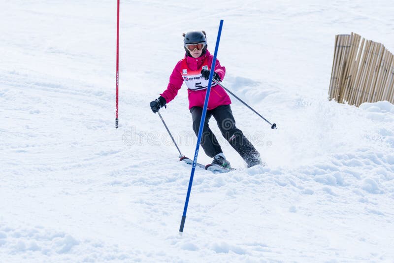 varicoza i ski cauzele femeilor varicoase