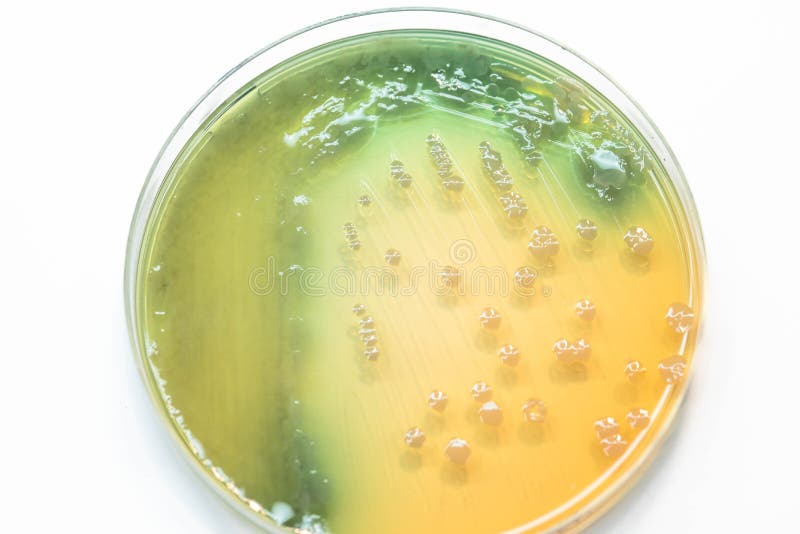Crecimiento bacteriano de la cultura de las colonias en el agar de MacConkey
