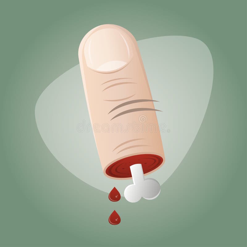 Cut Finger Cartoon Stock Illustrations 1,603 Cut Finger Cartoon Stock