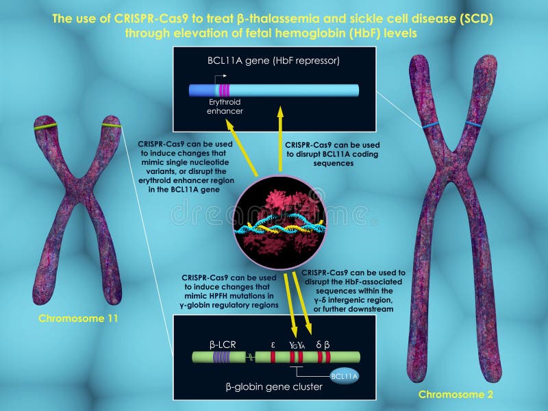 CRISPR-Cas9 para tratar beta-talasemia y la anemia de células falciformes stock de ilustración CRISPR-Cas9 para tratar beta-talasemia y la anemia de células falciformes stock de ilustración