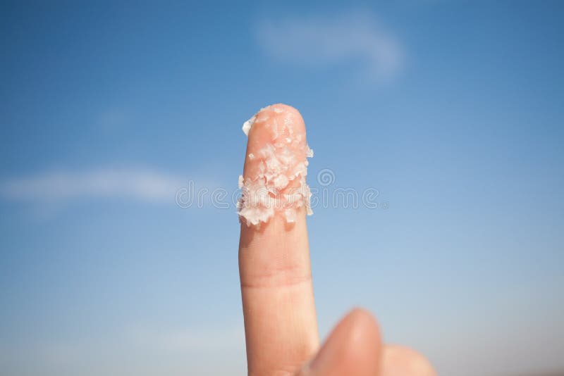 Big salt crystals on the finger. Big salt crystals on the finger