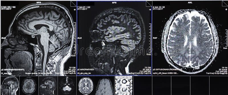 CT scans of human head