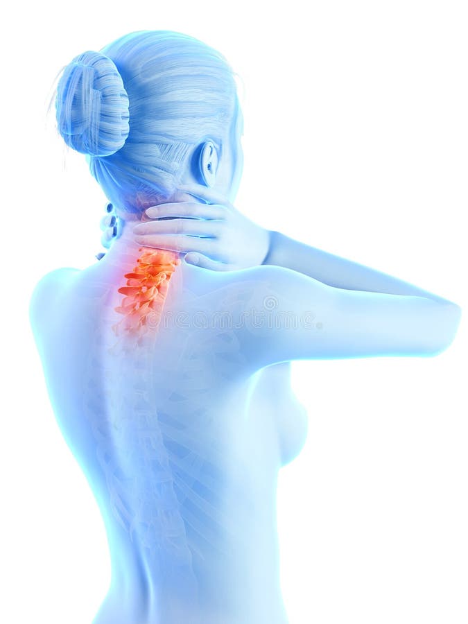 Cuello doloroso - espina dorsal visible