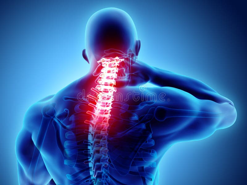 3D illustration, neck painful - cervical spine skeleton x-ray, medical concept. 3D illustration, neck painful - cervical spine skeleton x-ray, medical concept.