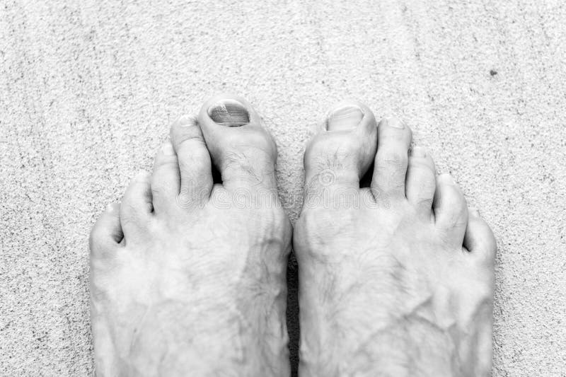 Cuide dos seus pés Pedicura e podiatria Tratamento de contusões e fraturas Conceito de medicina Dedos do pé do trauma imagens de stock Cuide dos seus pés Pedicura e podiatria Tratamento de contusões e fraturas Conceito de medicina Dedos do pé do trauma imagens de stock