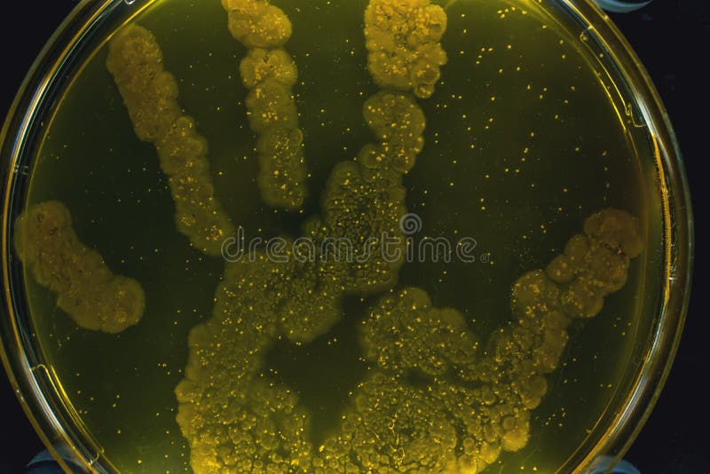 Cultura bacteriana colorida hermosa en hongo y bacterias del laboratorio de la placa de Petri