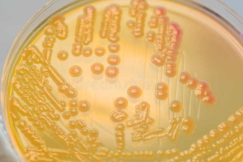 Cultura bacteriana de las colonias en medios del agar de MacConkey
