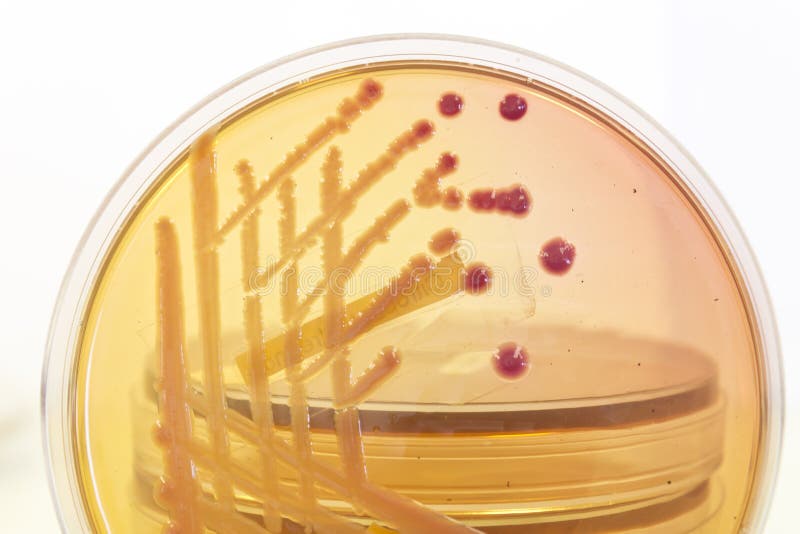 Cultura bacteriana del rosa y del amarillo en agar con otros platos en el fondo