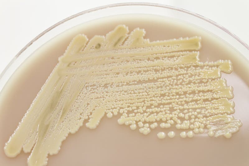Cultura bacteriana en agar