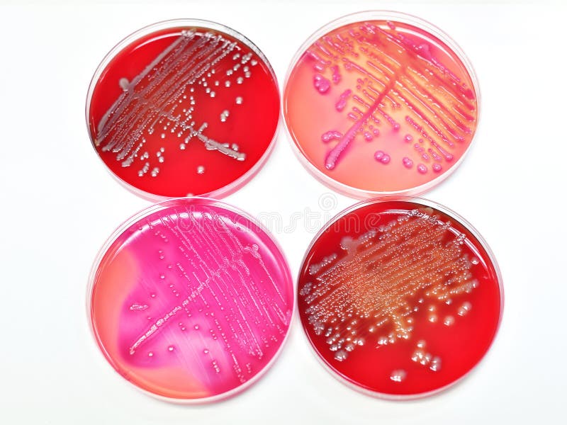 Cultura de las bacterias