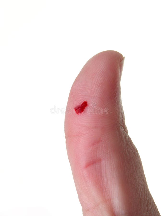 Cut Finger (2) stock photo. Image of slice, bleed, backlight 18682
