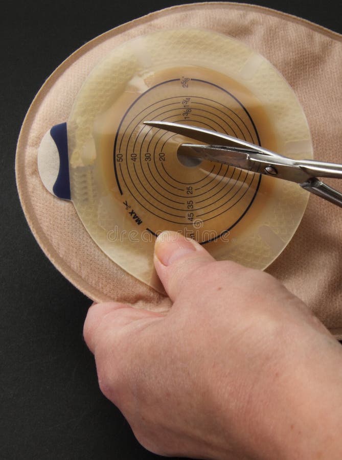 Colostomy Surgical Appliances Stock Photo Image of intestine, illness
