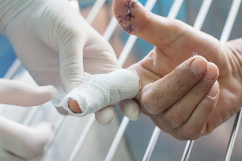 Cutting finger wound stock image. Image of cure, operation 155615899