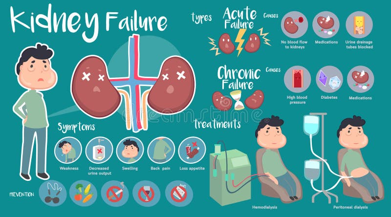 Cynaderki niepowodzenie infographic royalty ilustracja Cynaderki niepowodzenie infographic royalty ilustracja