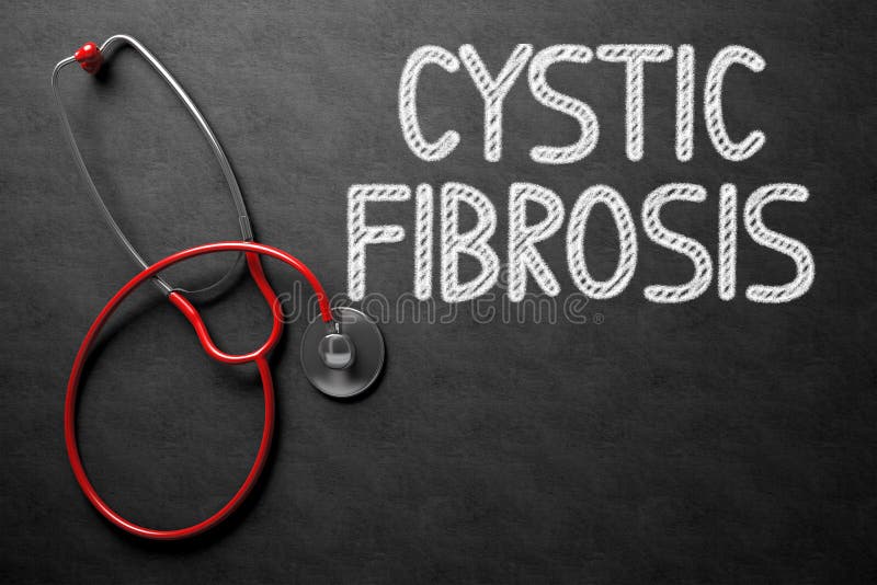 Medical Concept: Cystic Fibrosis on Black Chalkboard. Medical Concept: Cystic Fibrosis - Text on Black Chalkboard with Red Stethoscope. 3D Rendering. Medical Concept: Cystic Fibrosis on Black Chalkboard. Medical Concept: Cystic Fibrosis - Text on Black Chalkboard with Red Stethoscope. 3D Rendering.