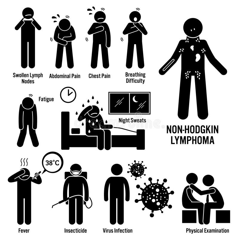 Cáncer linfático Clipart del linfoma no-Hodgkin libre illustration