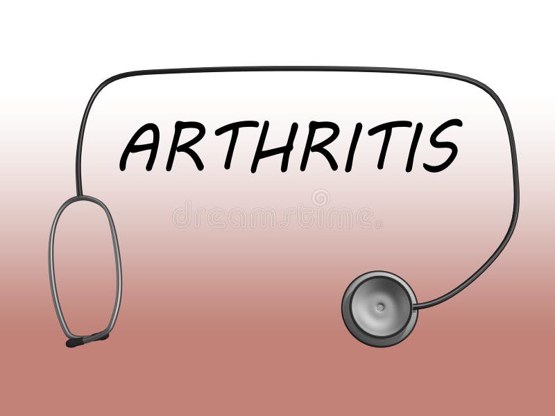 ARTHRITIS medical concept stock illustration. Illustration of adult
