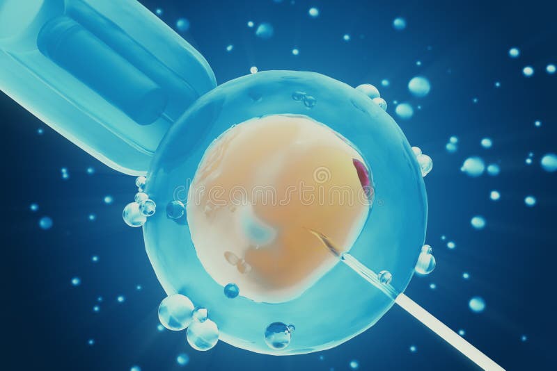 La inseminación in vitro