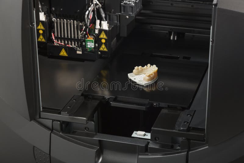 3D la stampante With Finished 3D ha stampato il ponte dell'impianto dentario