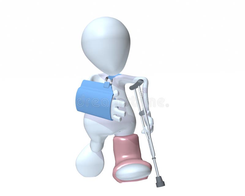 3d mens die op steunpilaren lopen die een gegoten wapenslinger en een voet dragen vector illustratie 3d mens die op steunpilaren lopen die een gegoten wapenslinger en een voet dragen vector illustratie