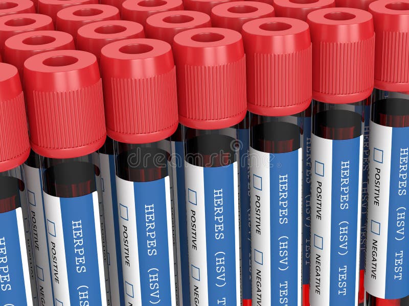 3d Render of Blood Samples with Herpes Test Stock Illustration