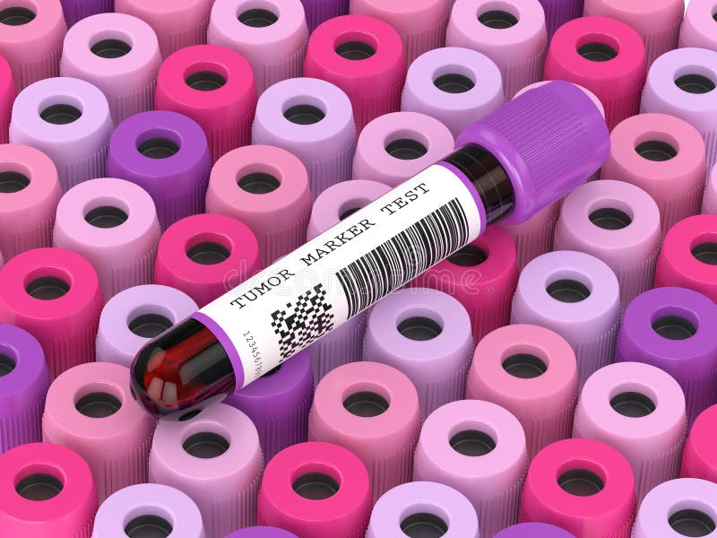 3d Render of Blood Samples with Tumor Marker Test Stock Illustration Illustration of exam