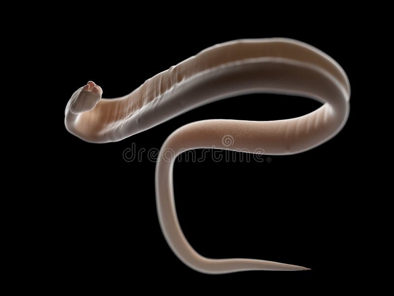 a pinwormok ascariasis)