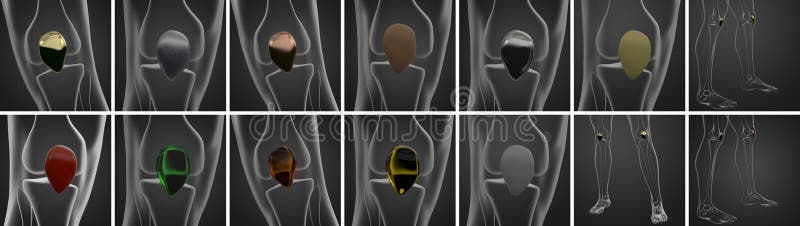 3d rendering medical illustration of the patella bone vector illustration.